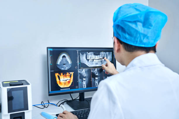Best Knocked-Out Tooth (Avulsed Tooth) Treatment in Emporium, PA